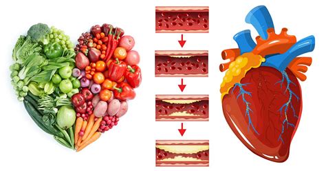 15 Heart-Healthy Nutrients You Should Be Eating To Prevent Coronary Heart Disease | DailyHealthPost