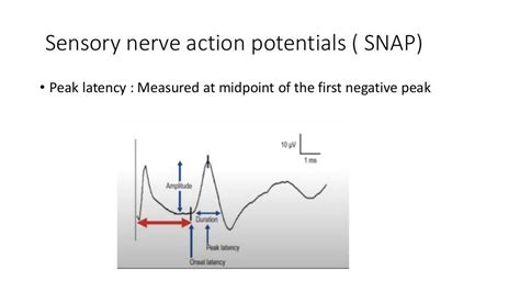 Nerve conduction studies