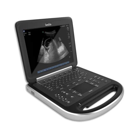 Philips CX50 Portable Ultrasound System - Avante Health Solutions