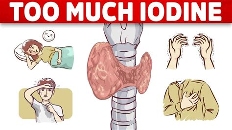 The #1 Sign of Iodine Overload (TOXICITY) - YouTube