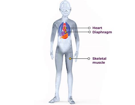 Duchenne Muscular Dystrophy Gene