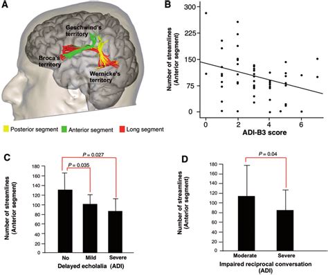 The anatomy of the arcuate fasciculus in relation to childhood ASD ...