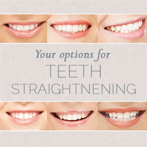 Teeth Straightening Options in Atlanta | Dr. Ceneviz