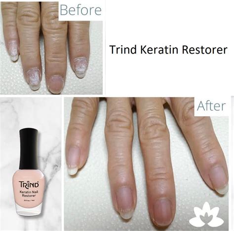 Trind Keratin Nail Restorer