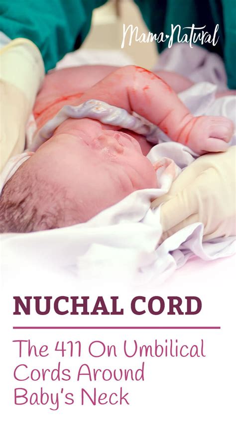 The Truth About Nuchal Cords (Umbilical Cord Around Baby’s Neck)