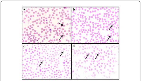 Blood film smear (A, B, C & D) showing red blood cells morphological... | Download Scientific ...