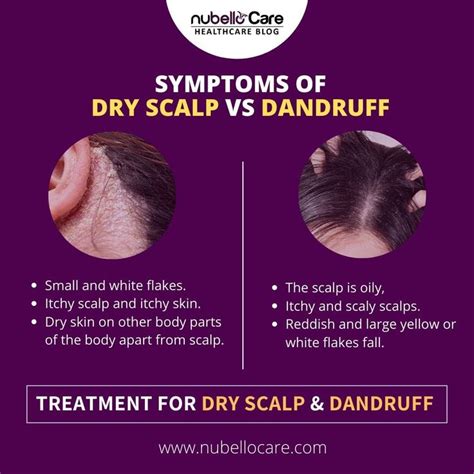 The right solution to get off the white flakes | Dry scalp vs dandruff ...