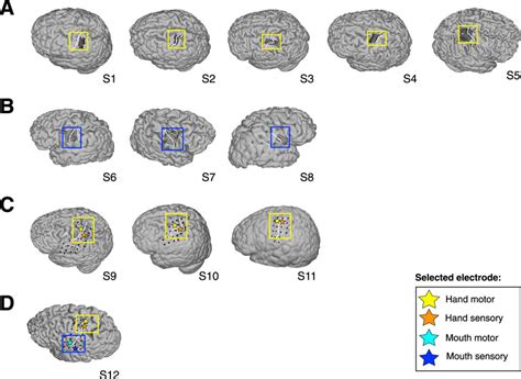 ECoG grid localization. (A)–(D) Brain surface renderings with projected... | Download Scientific ...