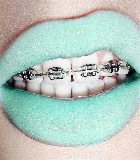 Mint green braces!! | Quinceanera Makeup | Pinterest | Mint green ...