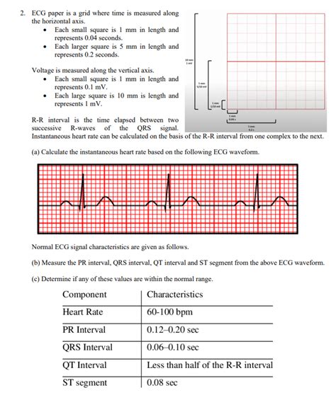 Solved 2. ECG paper is a grid where time is measured along | Chegg.com