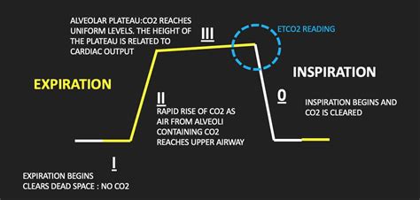 Capnography | Emergency Medicine Education | Resus