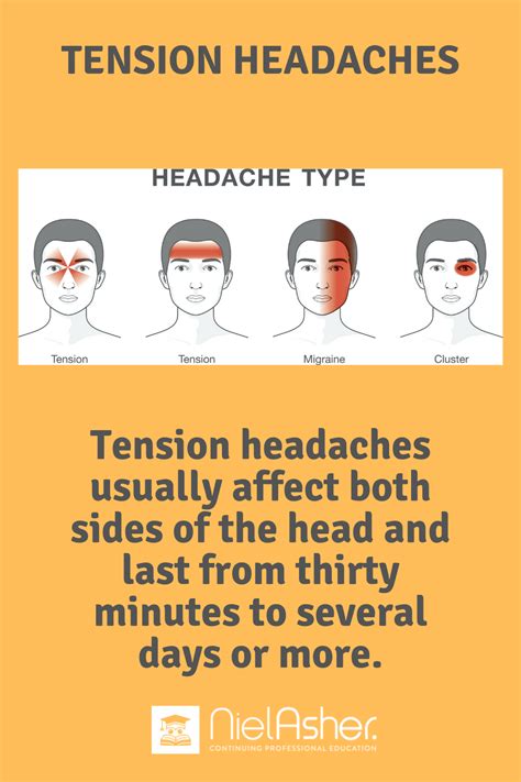 Treating tension headaches trigger point therapy headache headaches ...