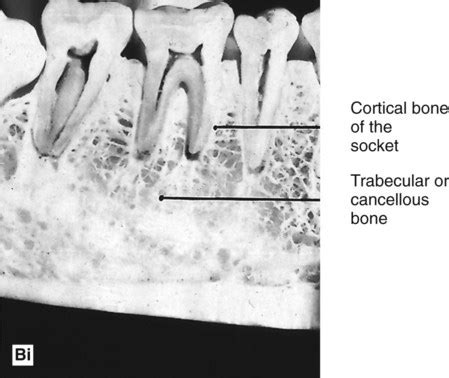 21: The periapical tissues | Pocket Dentistry