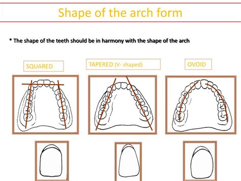 PPT - SELECTION OF ANTERIOR TEETH. PowerPoint Presentation, free ...