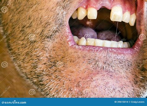 Missing Tooth stock photo. Image of mouth, tooth, root - 39615014