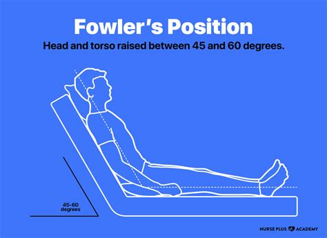 Fowler's position | Nurse Plus
