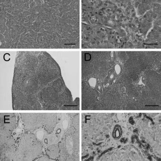 Histopathology of a quadrate lobe of the liver. Proliferation of bile... | Download Scientific ...