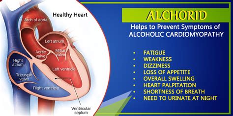 Natural Ways to Control Alcoholic Cardiomyopathy | Bagdara Farms