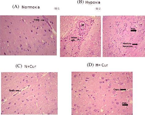 Brain Tissue Histology