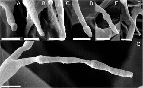 A: Primary sporangiophore tip after sporangium detachment. B–E ...