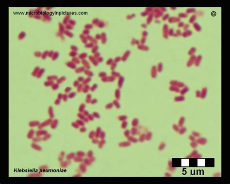 Klebsiella pneumoniae microscopy, Gram-stain. Klebsiella pneumoniae ...