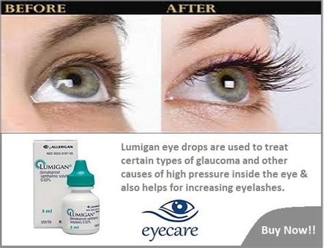 Lumigan eye drops uses dosage side effects – Artofit