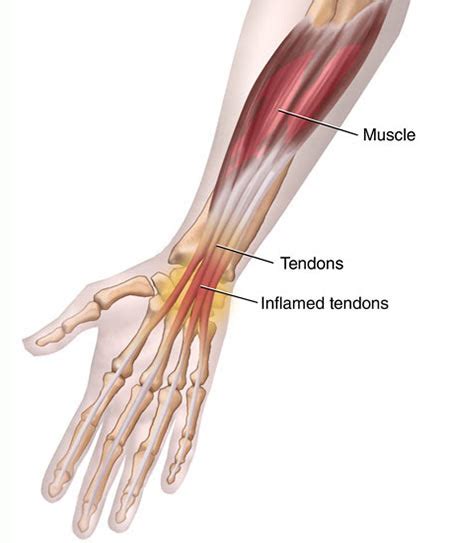 Wrist Tendon Anatomy