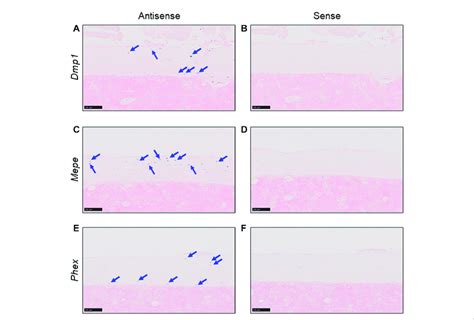 Detection of osteocyte marker mRNA using in situ hybridization.... | Download Scientific Diagram