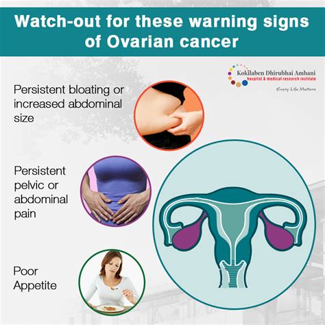 Ovarian Cancer