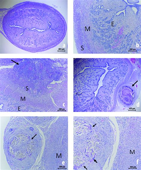 Uterine histology prior to 30 days after peritubal injury... | Download Scientific Diagram