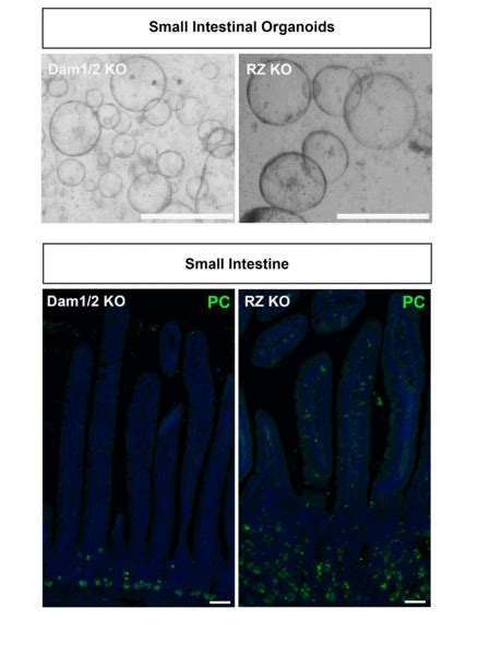 Unraveling Stem Cell Destiny in Intestinal Organoids