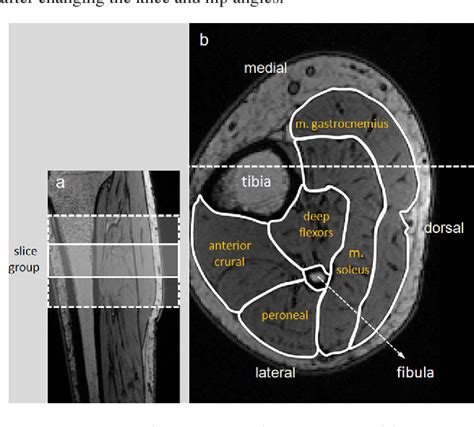 Magnetic resonance imaging assessment of mechanical interactions ...