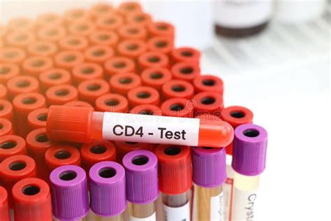 CD4 Test To Look for Abnormalities from Blood Stock Image - Image of ...