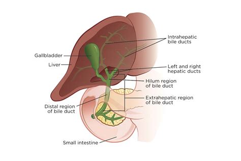 Types of Bile Duct Cancer (Cholangiocarcinoma) | Memorial Sloan ...