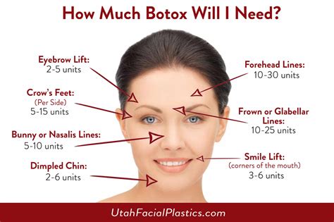 How Much Botox Will I Need? - Utah Facial Plastics