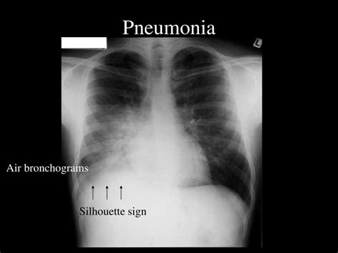 PPT - “What Test is Best” Choosing Radiology Exams in Emergency Settings PowerPoint Presentation ...