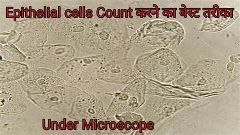 Urine Cells Under The Microscope