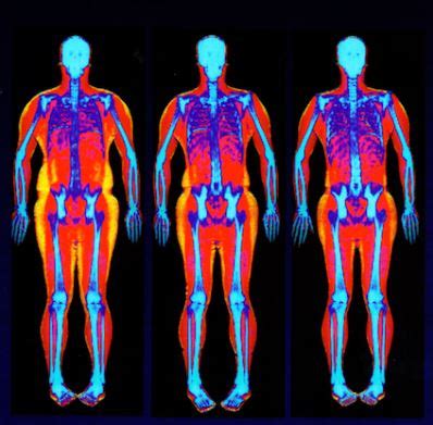 DEXA Body Composition Scan | Jackson Hospital