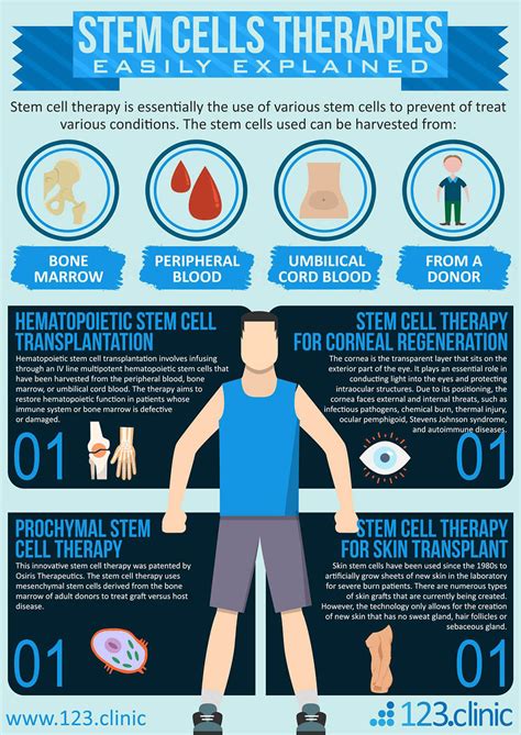 Stem Cells Therapies Easily Explained Infographic Infographics ...