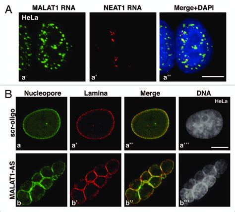 (A) Co-RNA-fiSH using probes against MALAt1 (a, green) and Neat1 (a ...