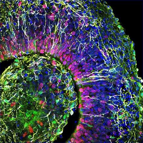 Can organoids, derived from stem cells, be used in disease treatments ...