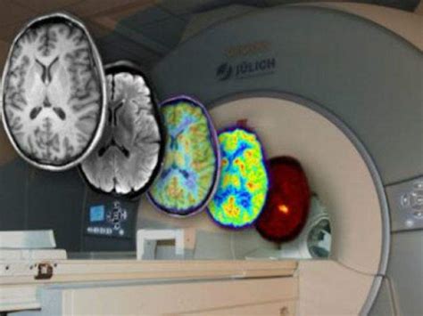 Human Brain Project researchers propose new imaging concept - Medical Device Network