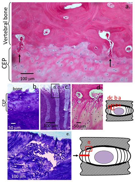 Annulus Fibrosus Histology