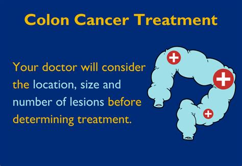 Colon Cancer Treatment: What to Know About Surgery | Johns Hopkins Medicine