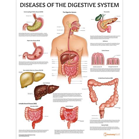 Diseases of the Digestive System Chart/Poster Laminated