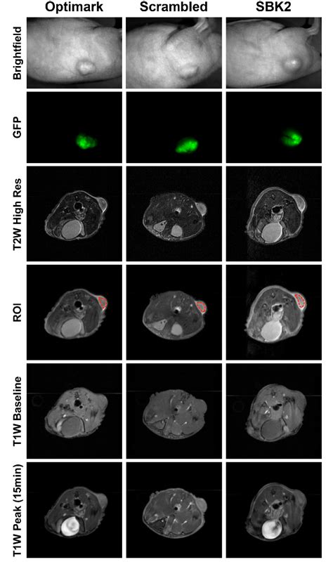 The SBK2-Tris-(Gd-DOTA)3 molecular imaging agent and the non-specific ...