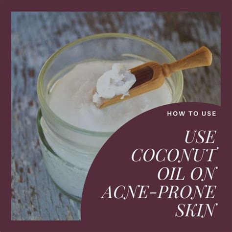 Coconut Oil for Acne: Does It Work? - HubPages