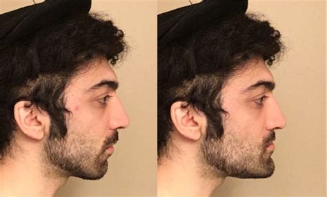 I had a facial analysis done -- can anyone help me interpret my results?