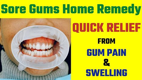 Sore Gums Home Remedy | Quick Relief From Gum Pain and Swelling | 5 ...