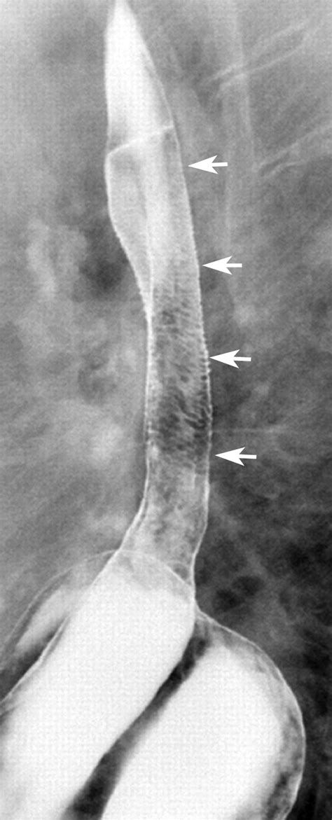 Feline Esophagus and Gastroesophageal Reflux | AJR